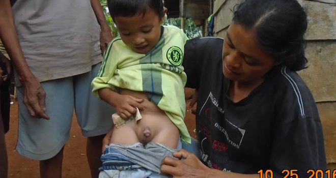 Rahmat, Bocah Yang Diduga Disunat Mahkluk Halus