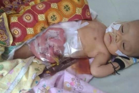 Muhammad Iksan Sayuti Putyra, bayi yang butuh uluran tangan para dermawan (Foto : Istimewa)